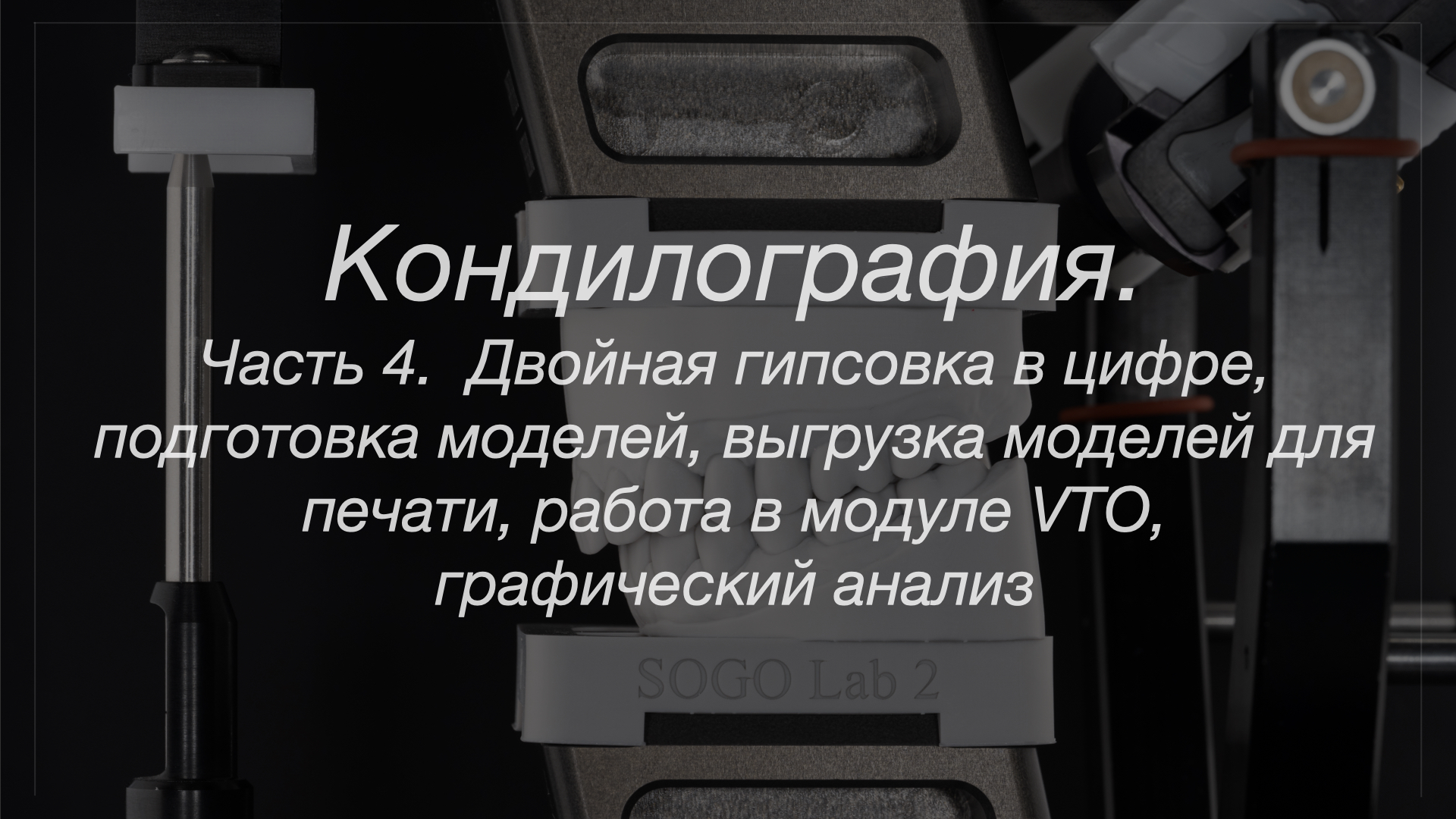 Кондилография. Часть 4. Двойная гипсовка в цифре, подготовка моделей и выгрузка моделей для печати, графический анализ и модуль виртуального планирования